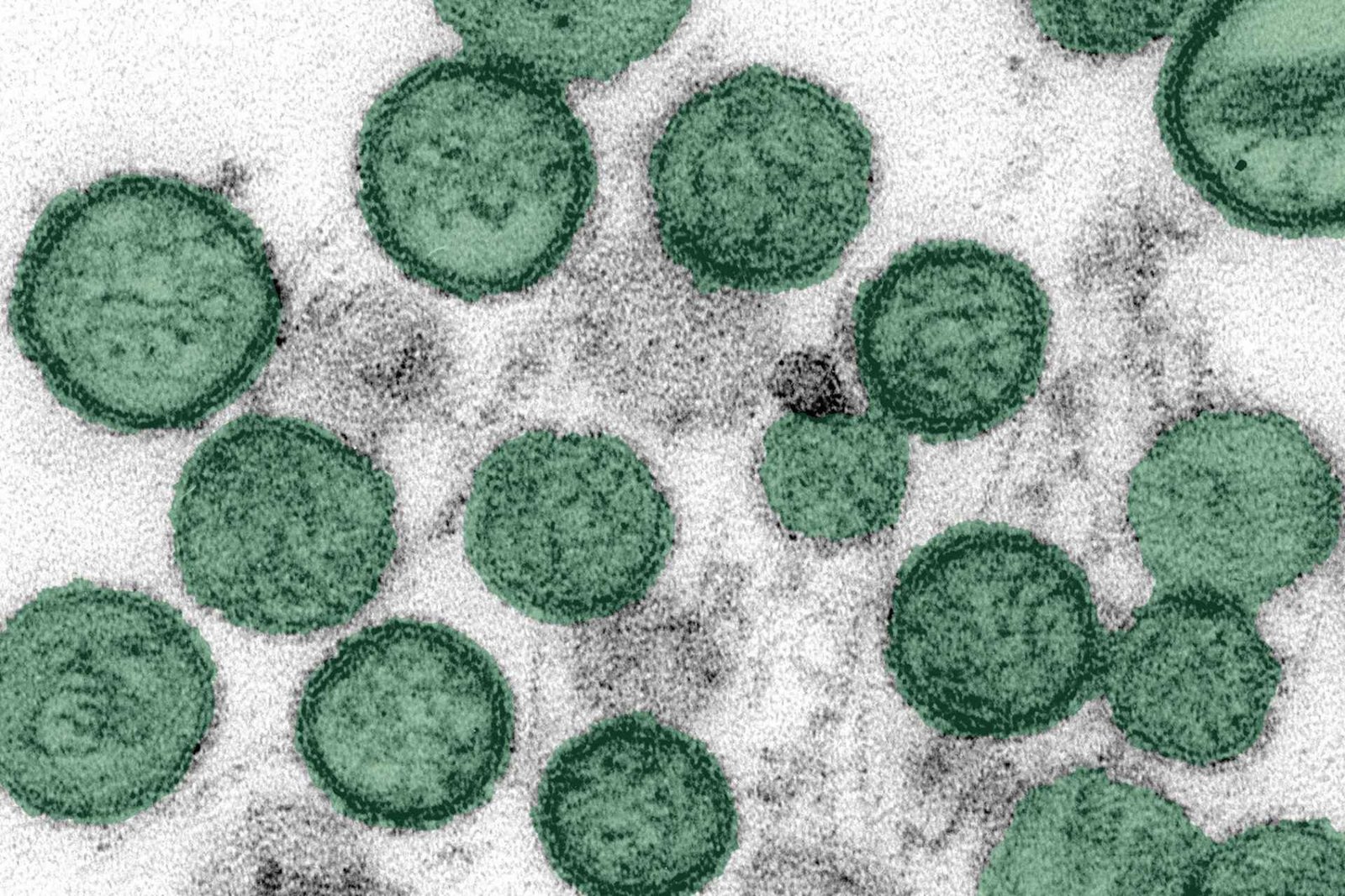 ¿Brote de hantavirus en un crucero puede convertirse en una epidemia? OMS responde