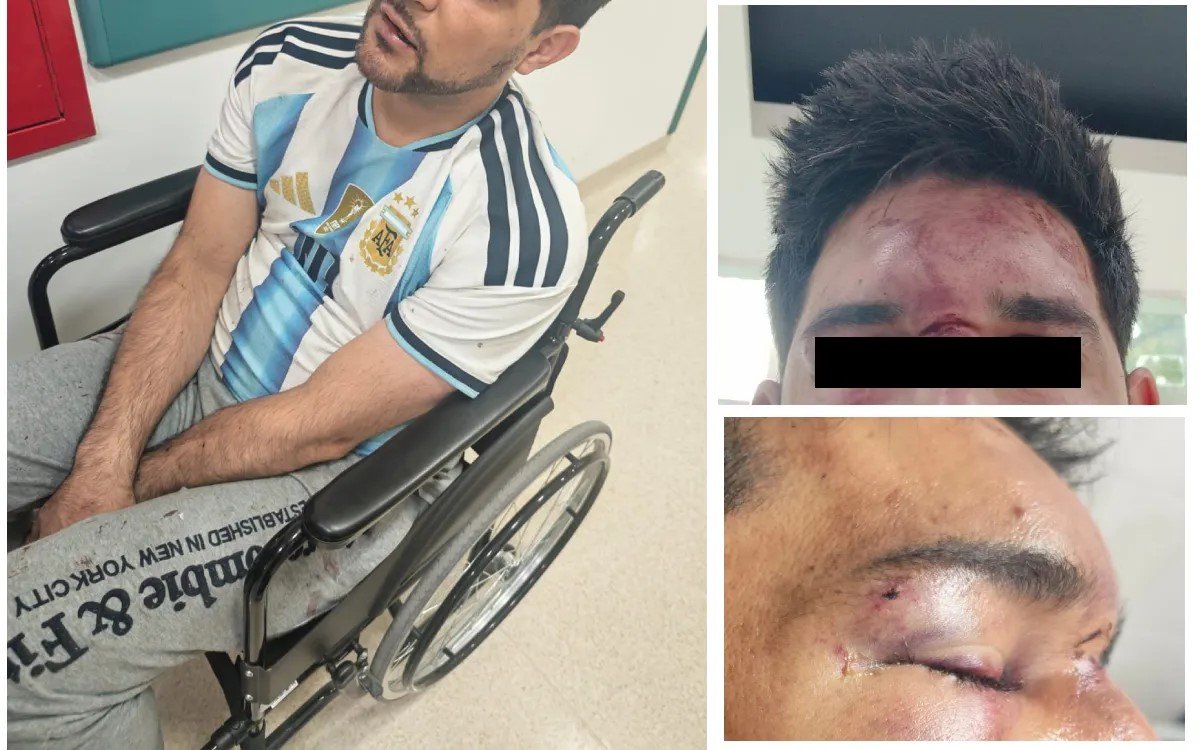 Xenofobia traspasa pantallas: Argentino golpeado brutalmente sacude a CDMX