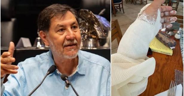 Fernández Noroña: Caída en Tepoztlán lo Saca Temporalmente de Escena
